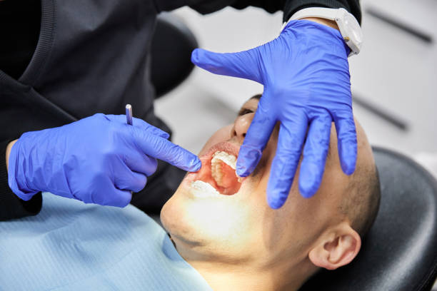 Best Emergency Tooth Extraction in Lynchburg, MS